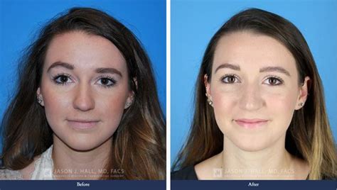 best plastic surgeon knoxville tn|trillium plastic surgery knoxville tn.